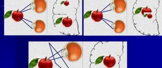 Anisometropia