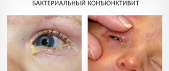 Бактериальная форма