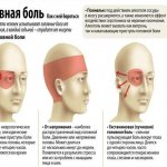 Headache from glasses