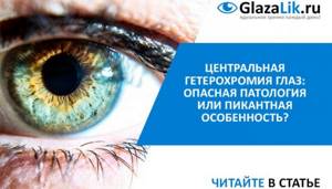 Центральная гетерохромия глаз у человека