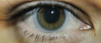 Что такое склеральные контактные линзы и для чего они применяются