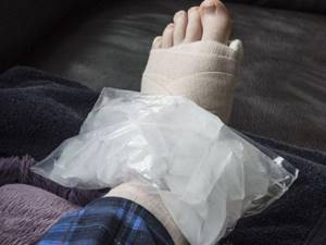 Фото: компресс при травме ноги