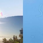 Фотопсия симптомы