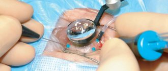 Where is vitrectomy surgery performed in Moscow, the cost of the operation
