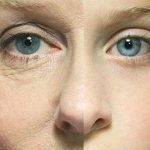 гепариновая мазь от морщин под глазами отзывы