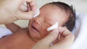 Гигиена глаз новорожденного