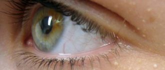 eye