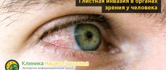 Worms in the eyes: symptoms and treatment of parasites in the organs of vision