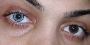 Голубые линзы на карих глазах