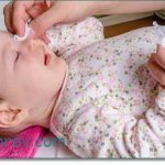 Как быстро лечить ячмень на глазу у ребенка