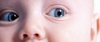 Как передается конъюнктивит глазной у детей?