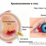 Как возникает патология