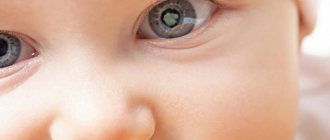 катаракта у детей причины