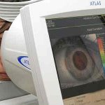 Computer keratotopography of the cornea in Moscow