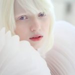 Красные глаза у альбиноса