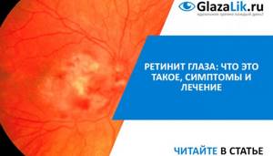 лечение ретинита