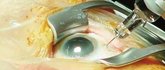 Lucentis: reviews and analogues, intravitreal injection, injection