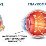 Механизм воздействия на ДЗН