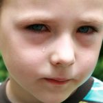 Мешки под глазами у мальчика 6 лет