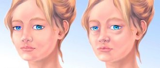 Diuretics for facial swelling. The best harmless tablets of the new generation