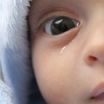 Непроходимость носослезного канала у детей