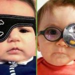 occluders for children