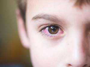 Оксолиновая мазь для лечения глазных болезней у детей