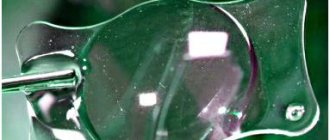 Операция замены хрусталика на оба глаза