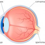 Отек глаз после операции катаракты