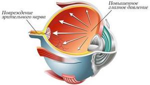 Питание при глаукоме при повышенном и пониженном давлении внутри глаз