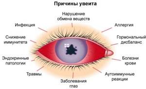 Покраснение глаз у ребенка. Причины и лечение при простуде, ОРВИ, температуре, аллергии. Капли и народные средства