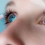 After laser correction