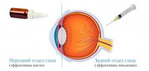 Препараты для укрепления и профилактики болезней сетчатки глаза