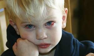 Причины кровоизлияния в глазу у ребенка