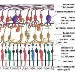 Causes of retinal detachment