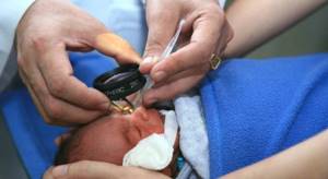 Ретинопатии сетчатки у новорожденных диагностика и лечение