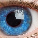 симптомы иридоциклита