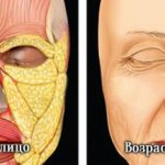 Causes of dark circles under eyes. Age-related changes and dark circles under the eyes 