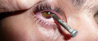 eye injury from foreign objects eye injury from foreign objects