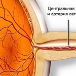 Тромбоз вены сетчатки глаза | FedorovMedCenter.ru