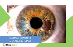 варианты лечения меланомы глаза за рубежом