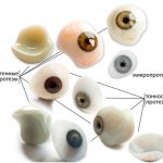 Виды глазных протезов