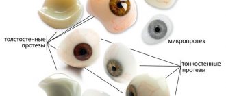 Виды глазных протезов