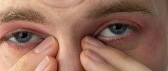 itchy eyes